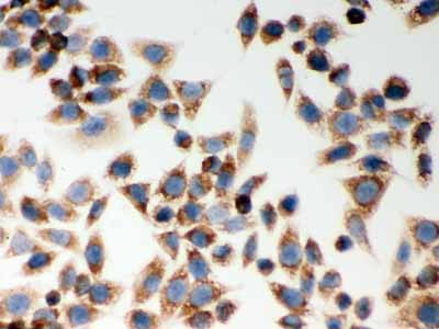 2 - Anti-CARD4 Picoband Antibody ABO11985