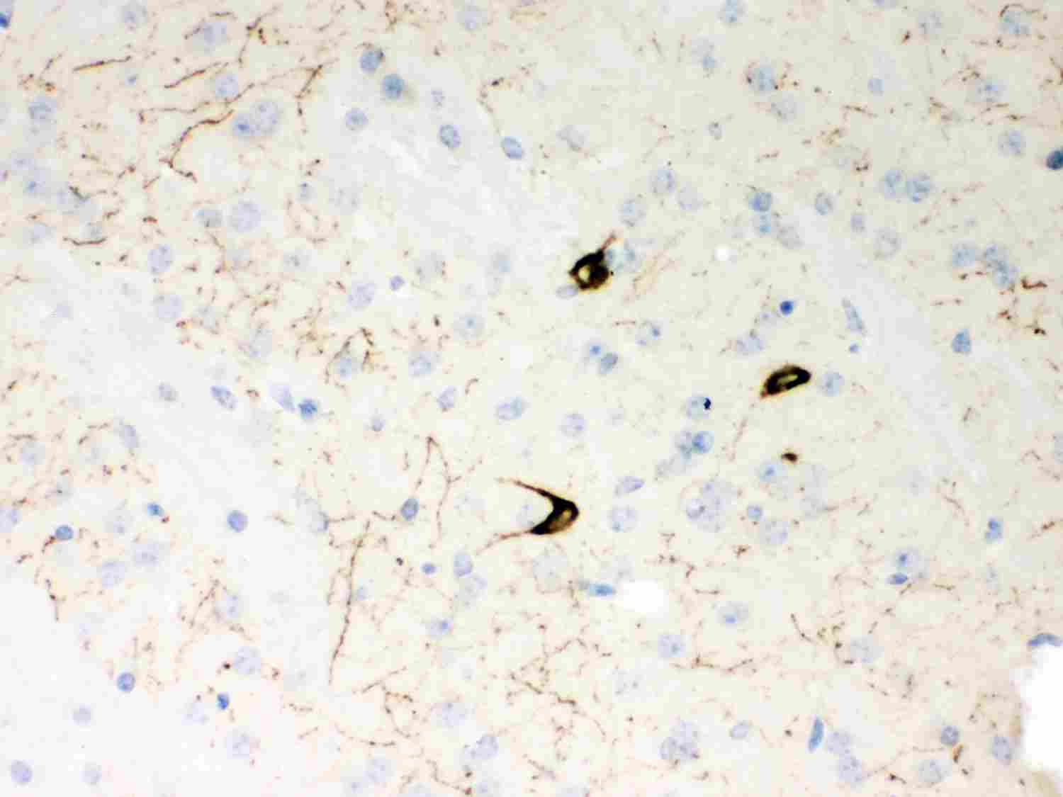 2 - Anti-Neuropeptide Y Picoband Antibody ABO11987
