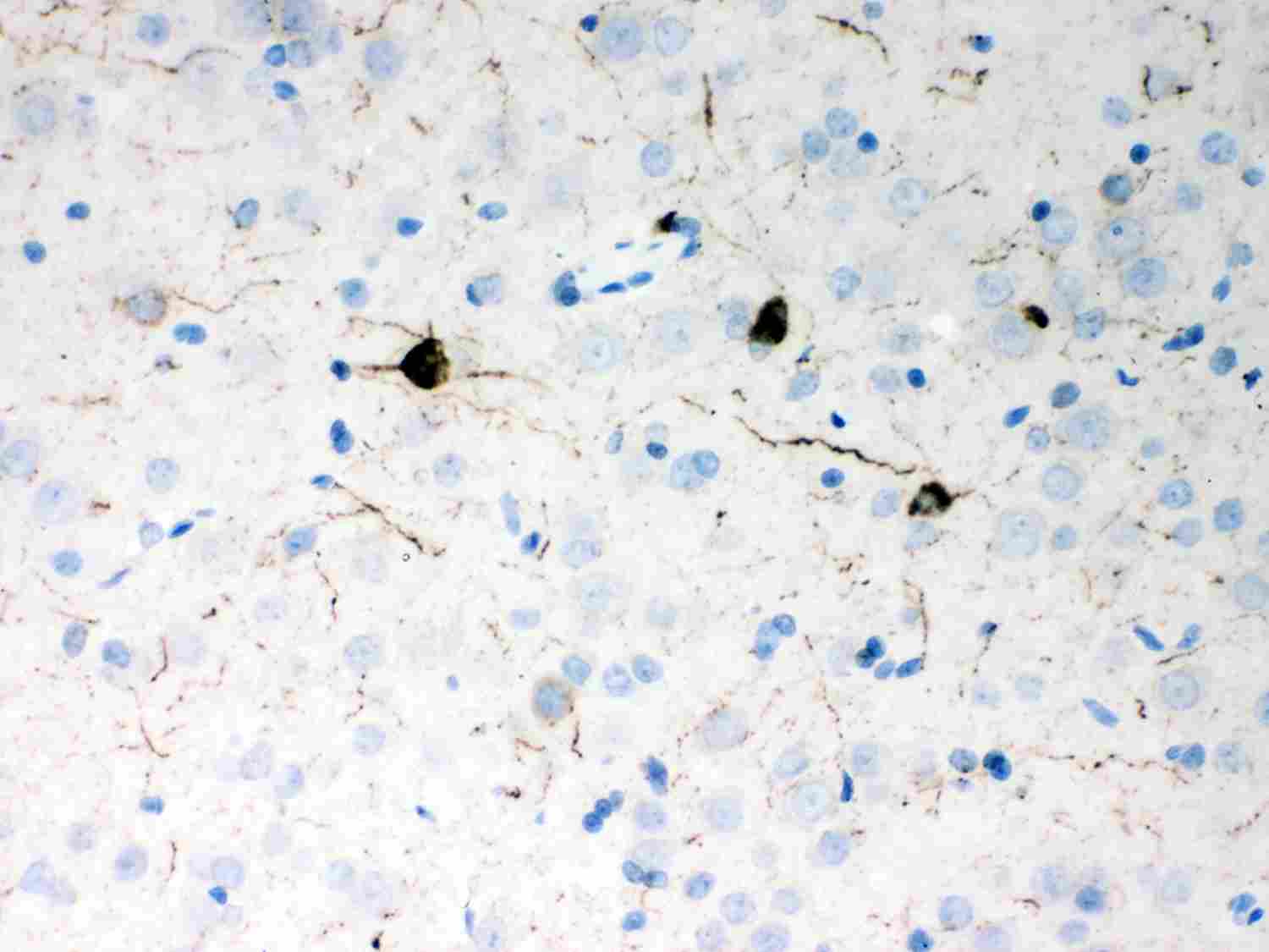 2 - Anti-Neuropeptide Y Picoband Antibody ABO11987
