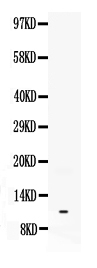 1 - Anti-Neuropeptide Y Picoband Antibody ABO11987