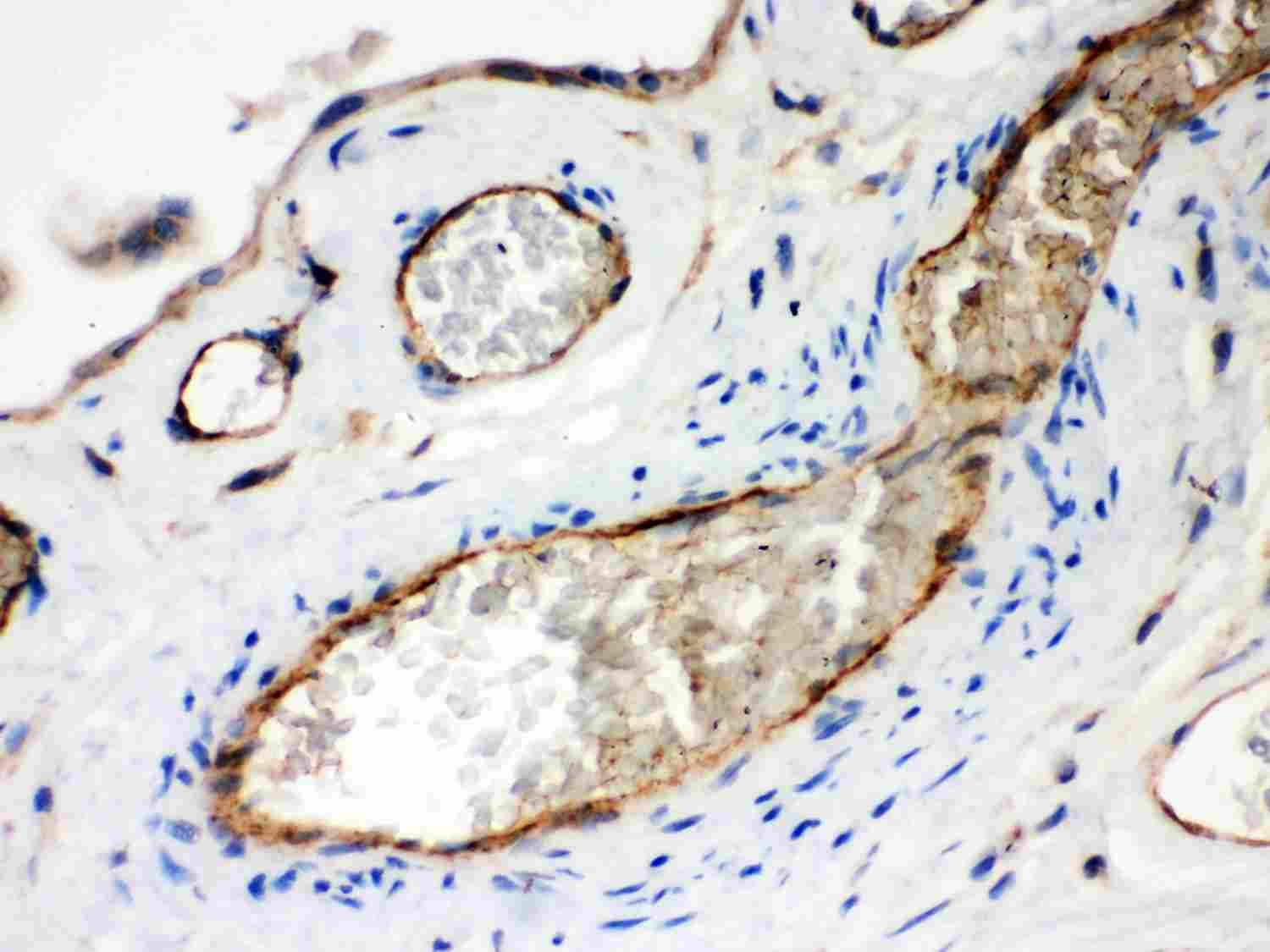 2 - Anti-Neuropilin-1 Antibody ABO11991