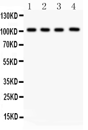 1 - Anti-Neuropilin-1 Antibody ABO11991