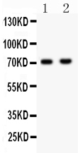 1 - Anti-NUMB Picoband Antibody ABO11992