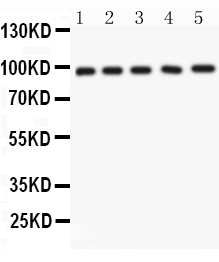1 - Anti-NUP98 Picoband Antibody ABO11993