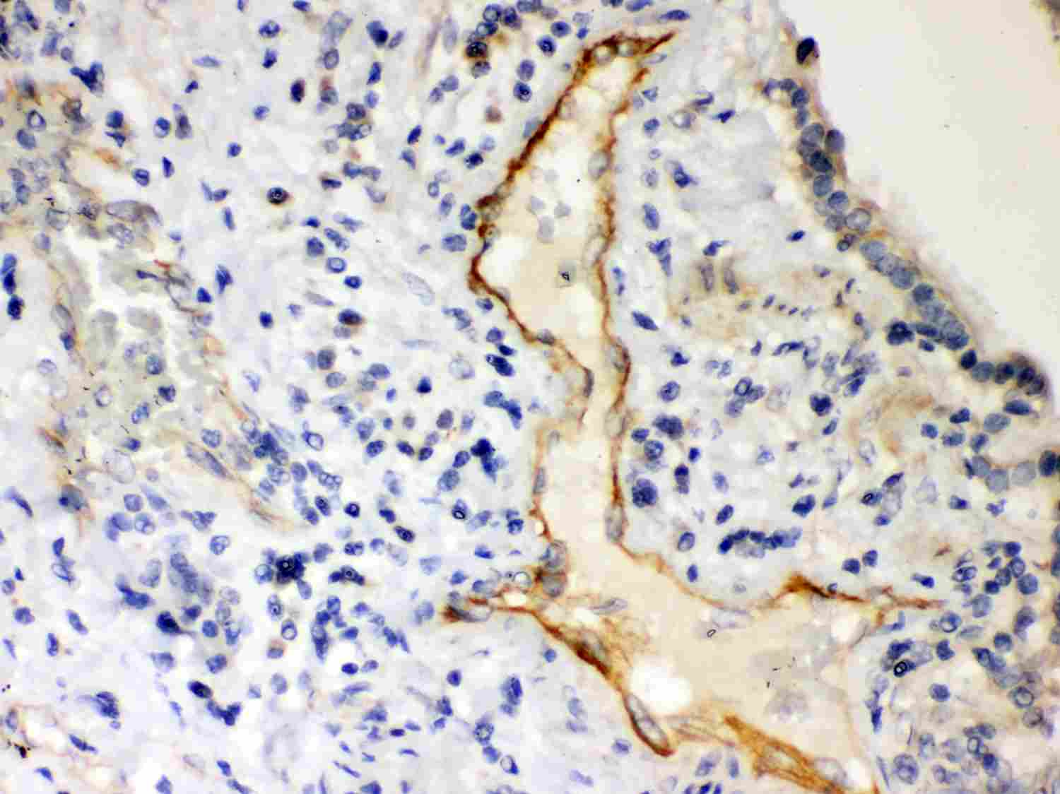 2 - Anti-P2X2 Picoband Antibody ABO11994