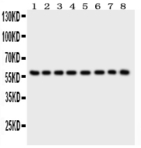 1 - Anti-P2X2 Picoband Antibody ABO11994