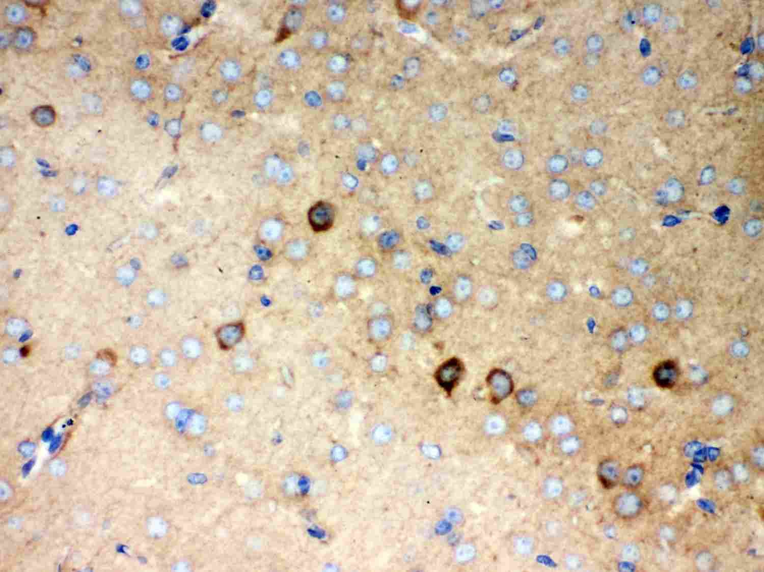 2 - Anti-P2X5 Picoband Antibody ABO11996