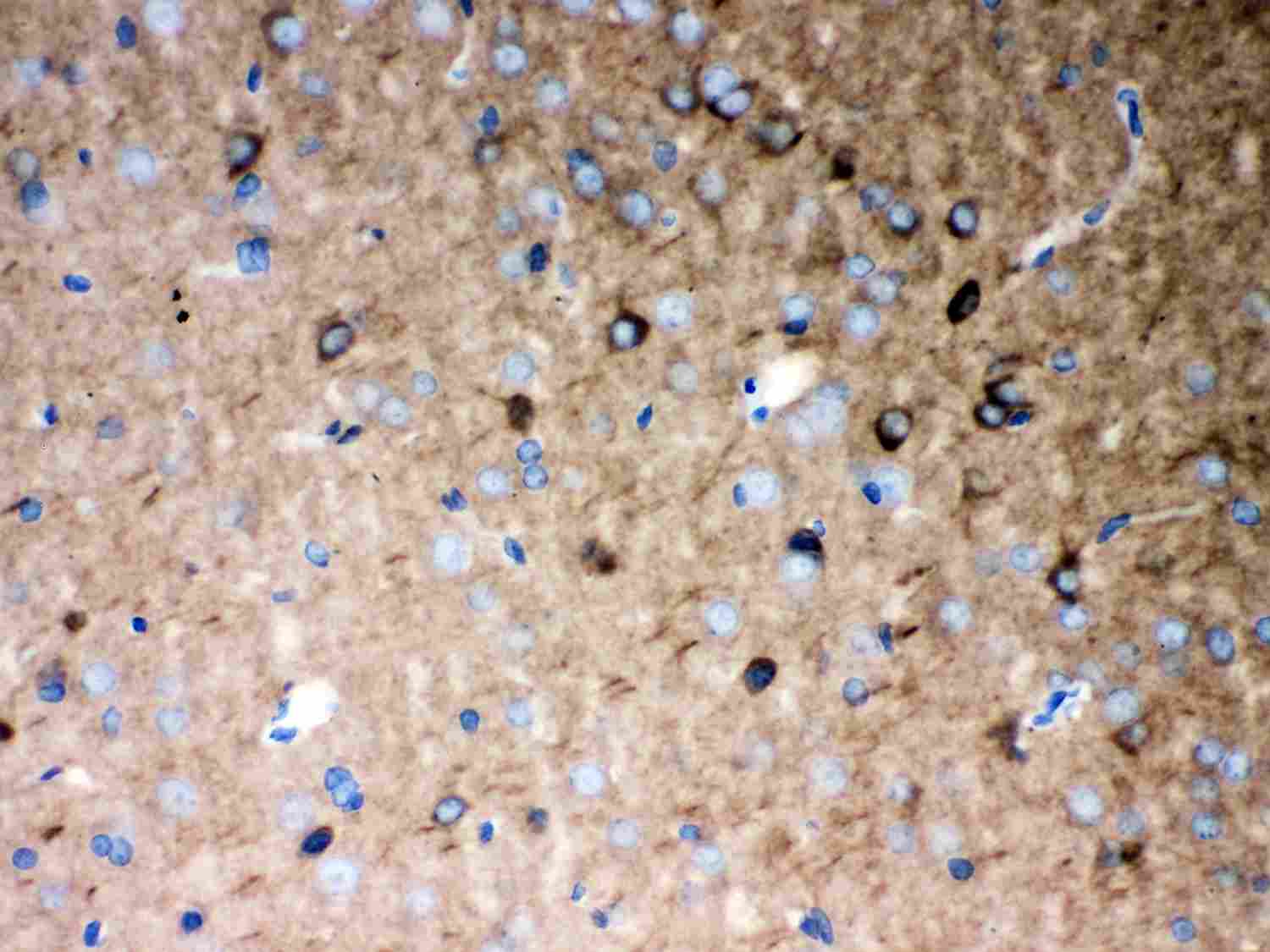 2 - Anti-P2X5 Picoband Antibody ABO11996