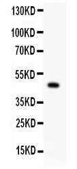 1 - Anti-P2X5 Picoband Antibody ABO11996