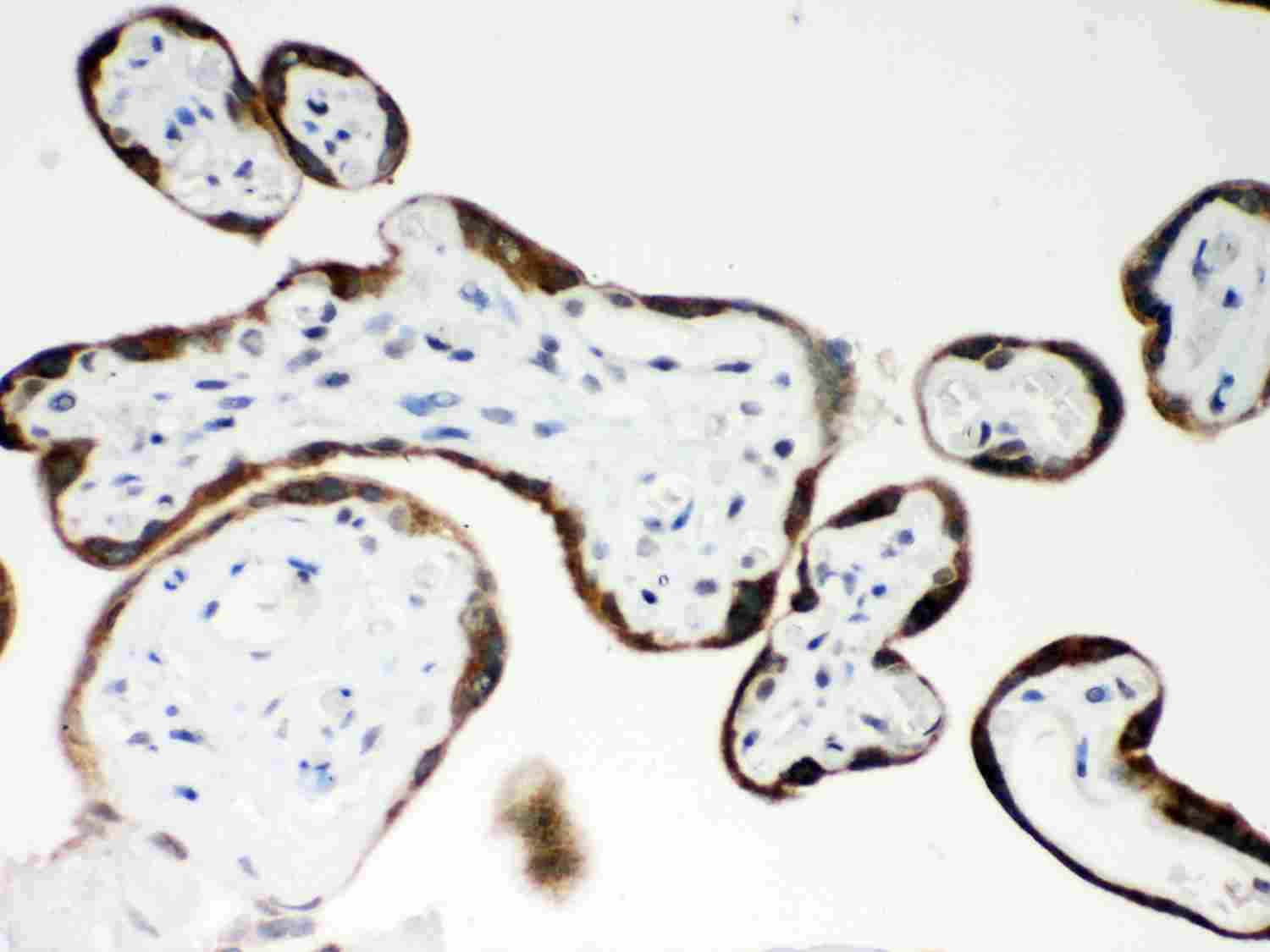 2 - Anti-PAPP A Picoband Antibody ABO11997