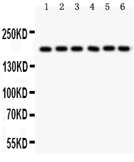 1 - Anti-PAPP A Picoband Antibody ABO11997