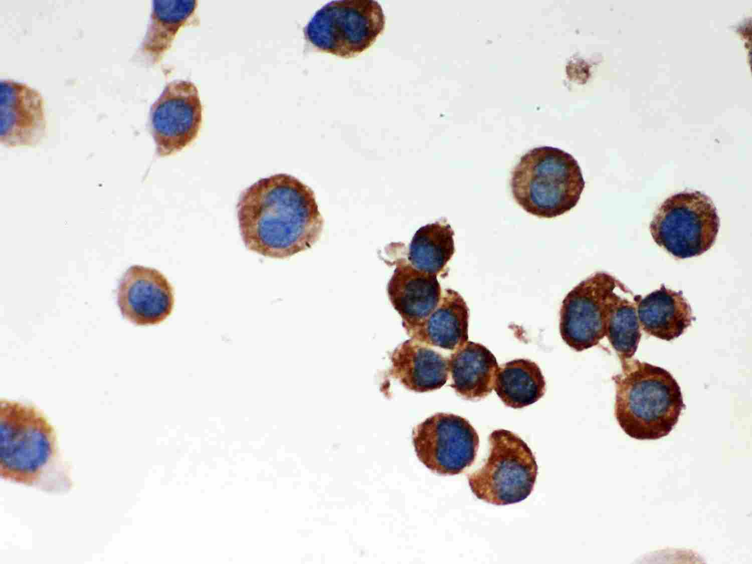 8 - Anti-Parkin Picoband Antibody ABO11998