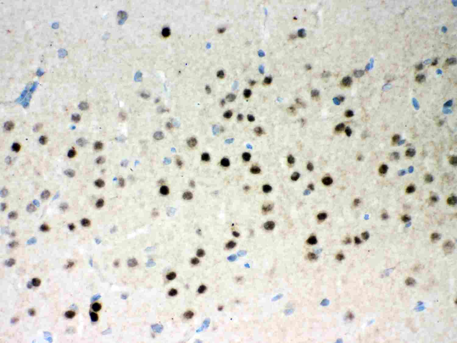 2 - Anti-Parkin Picoband Antibody ABO11998