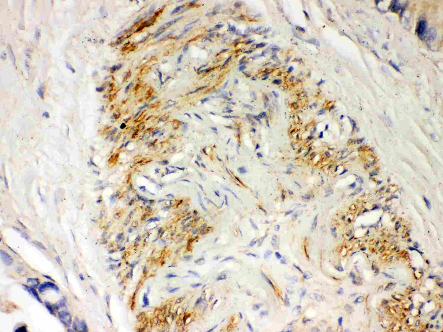 2 - Anti-Parkin Picoband Antibody ABO11998