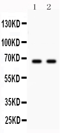 1 - Anti-Parkin Picoband Antibody ABO11998