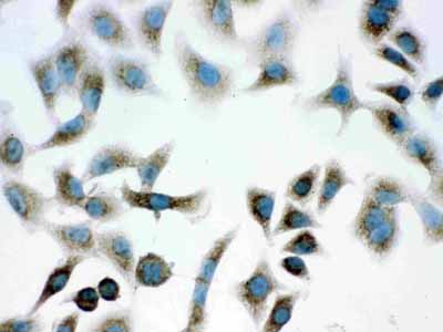 8 - Anti-PARK7/DJ1 Picoband Antibody ABO11999