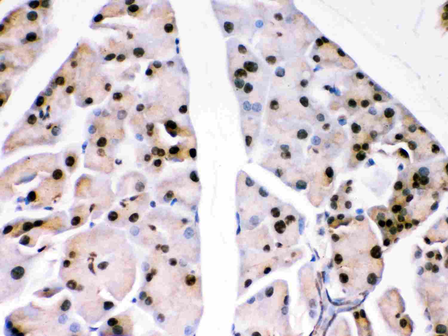 2 - Anti-PARK7/DJ1 Picoband Antibody ABO11999