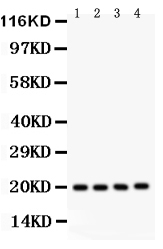 1 - Anti-PARK7/DJ1 Picoband Antibody ABO11999