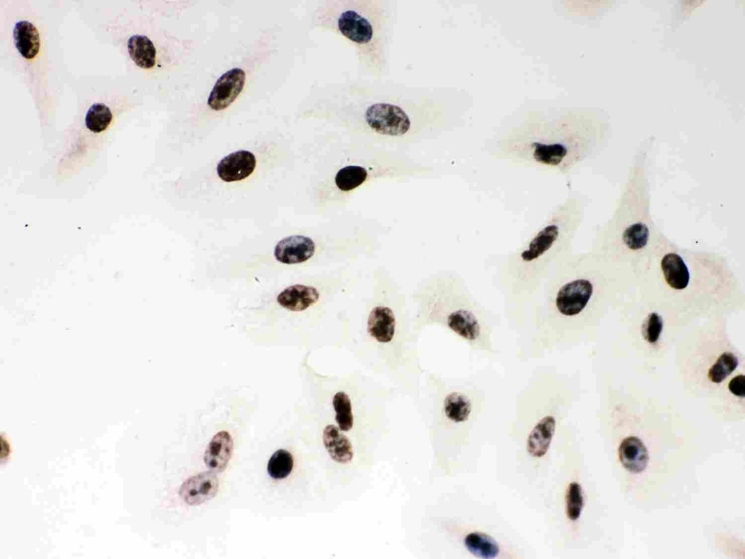 8 - Anti-PARP Picoband Antibody ABO12000
