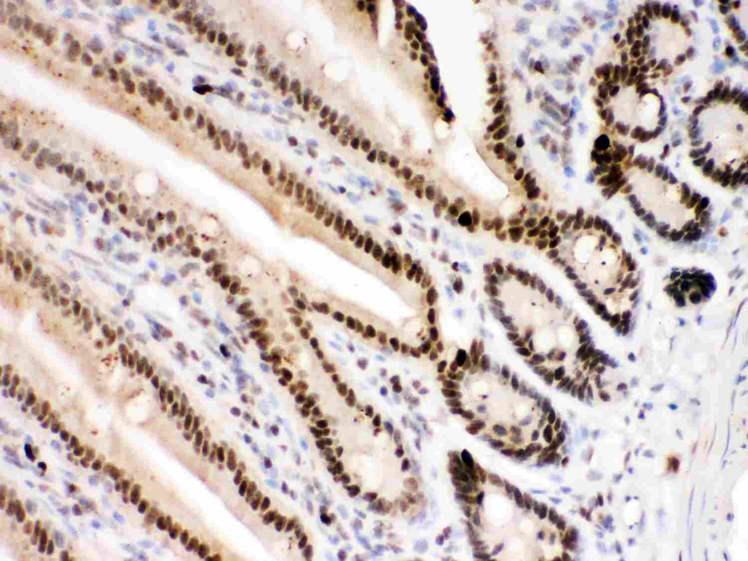 2 - Anti-PARP Picoband Antibody ABO12000