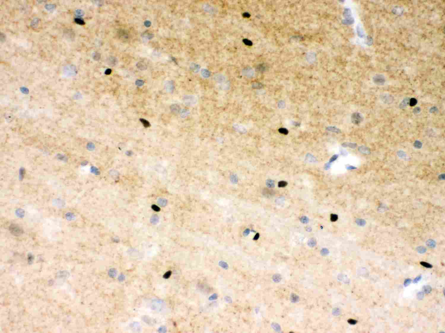 2 - Anti-PARP Picoband Antibody ABO12000