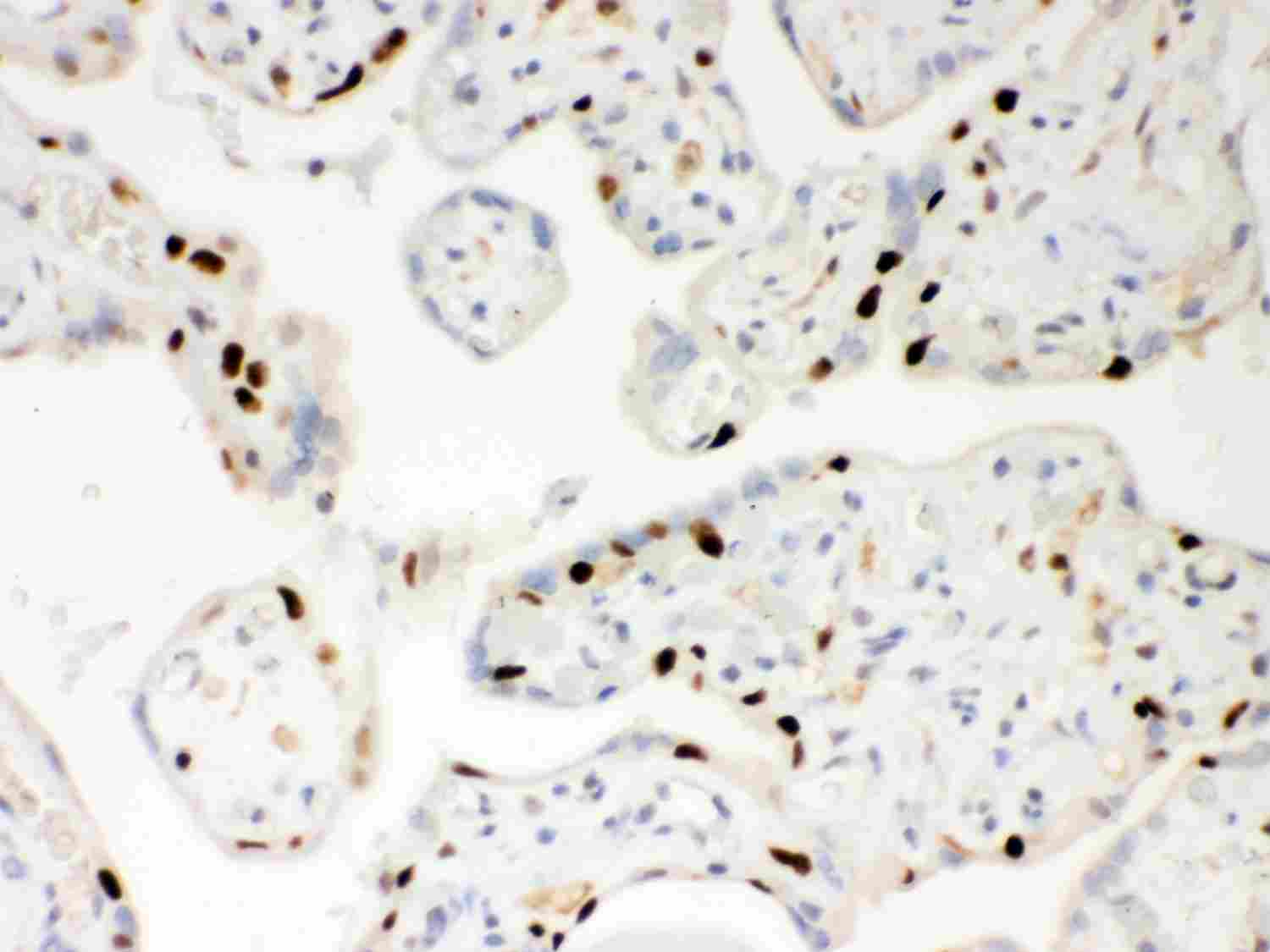 2 - Anti-PARP Picoband Antibody ABO12000