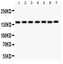 1 - Anti-PARP Picoband Antibody ABO12000