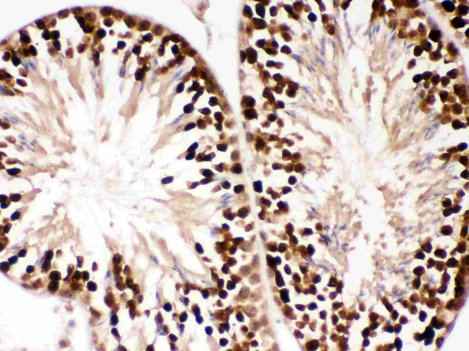 2 - Anti-PBK Picoband Antibody ABO12001