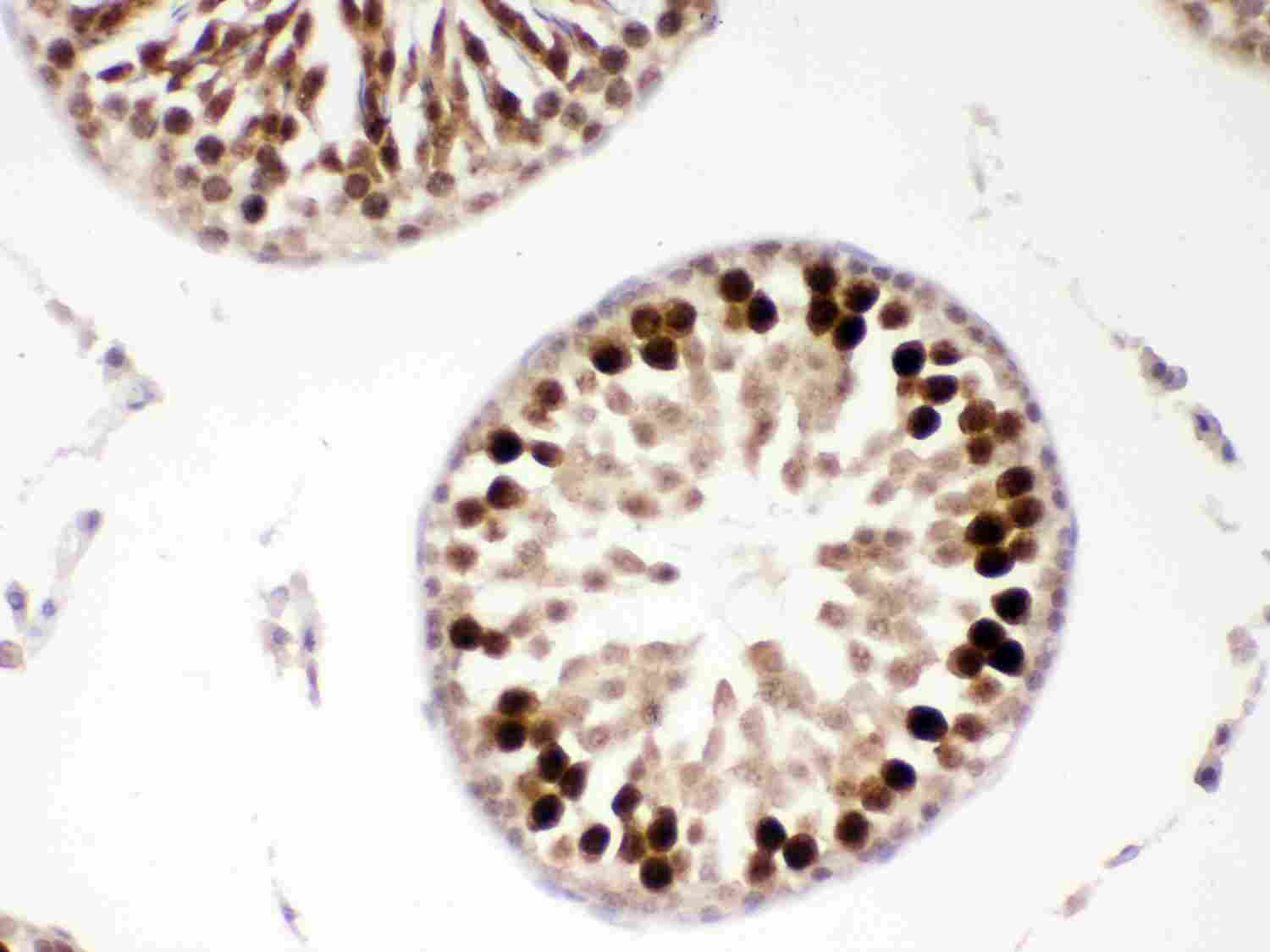 2 - Anti-PBK Picoband Antibody ABO12001