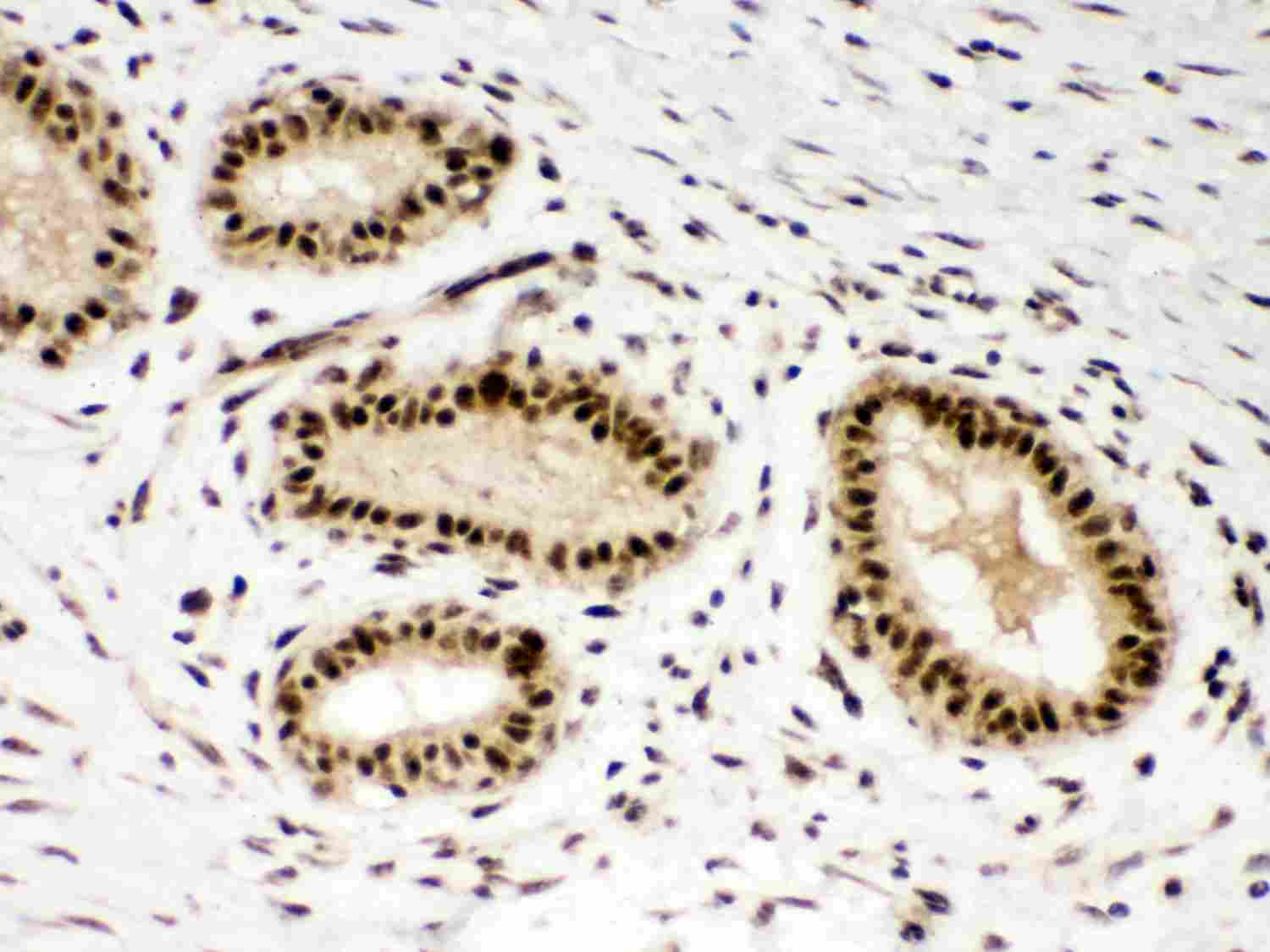 2 - Anti-PBK Picoband Antibody ABO12001