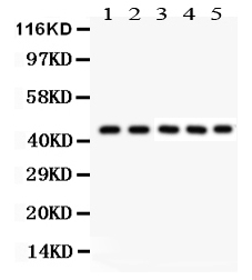 1 - Anti-PIM1 Picoband Antibody ABO12006