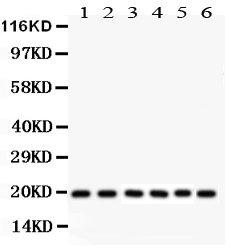 1 - Anti-Pin1 Picoband Antibody ABO12007
