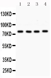 1 - Anti-PKC Alpha Picoband Antibody ABO12009