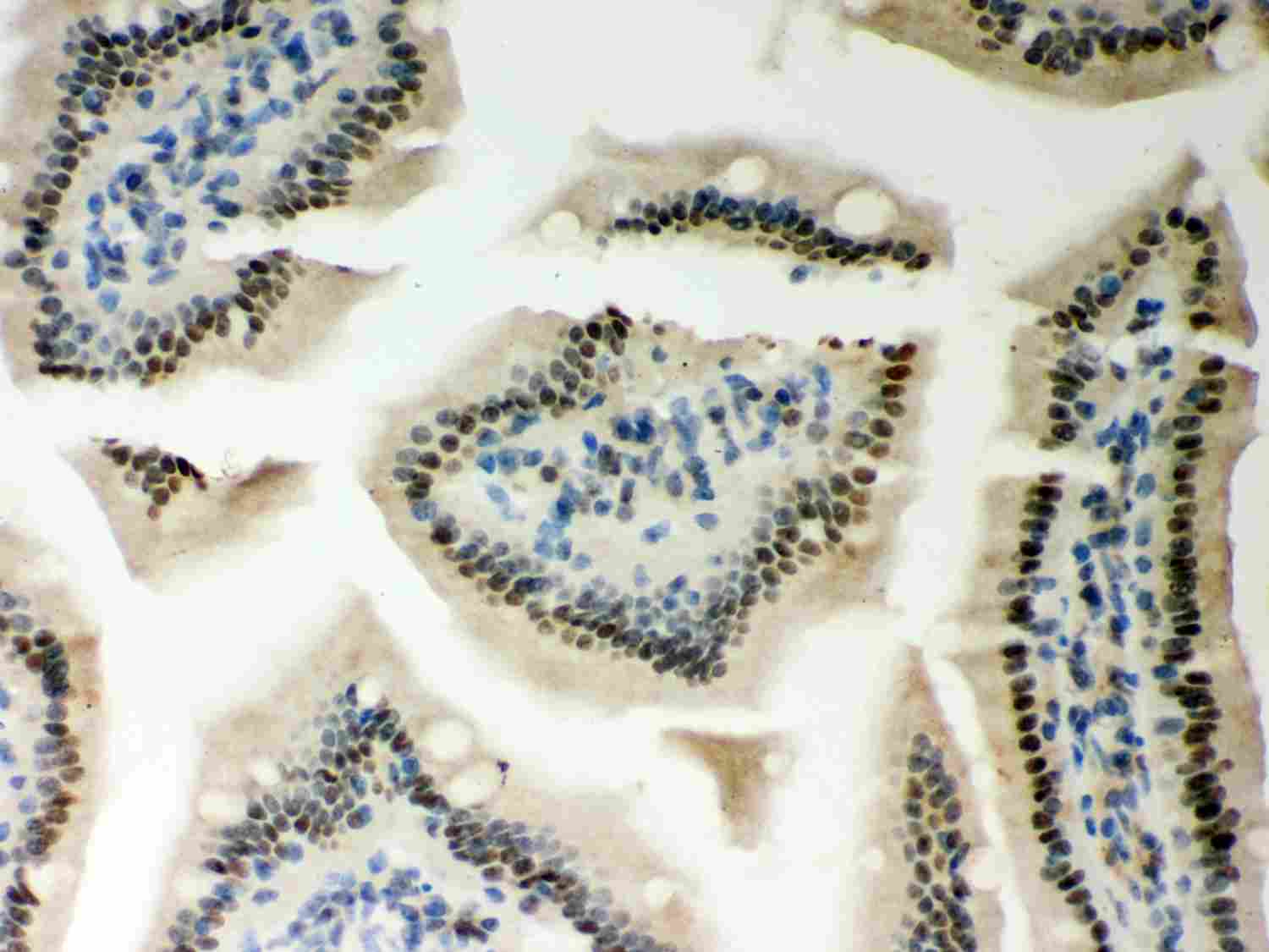 2 - Anti-PKC Epsilon Picoband Antibody ABO12011