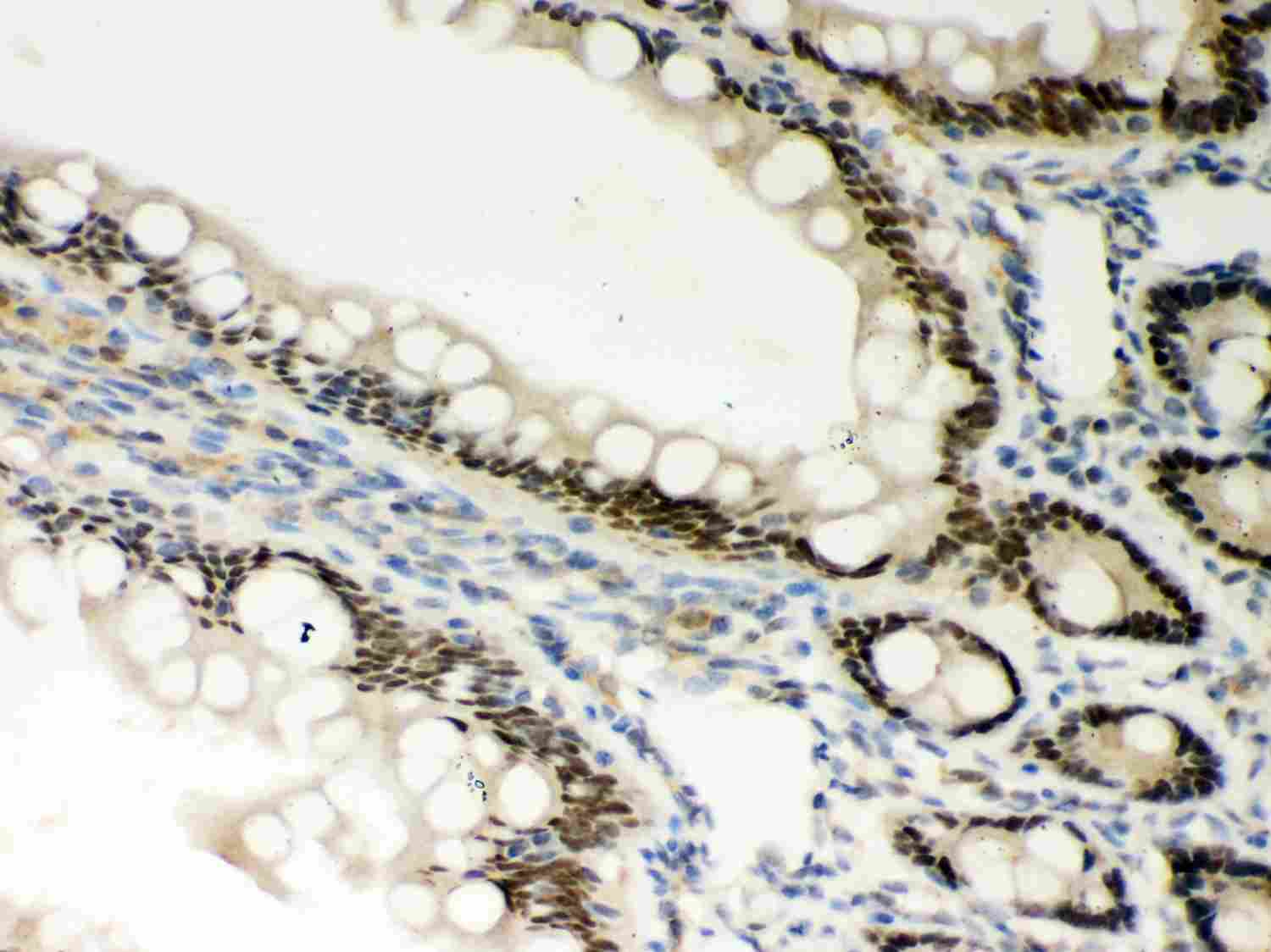 2 - Anti-PKC Epsilon Picoband Antibody ABO12011