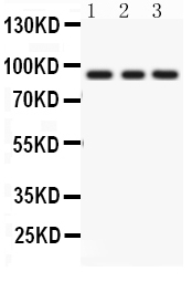 1 - Anti-PKC Epsilon Picoband Antibody ABO12011