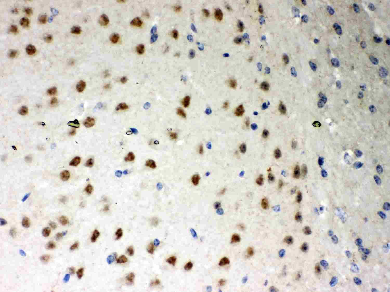 2 - Anti-PKC Iota Picoband Antibody ABO12012