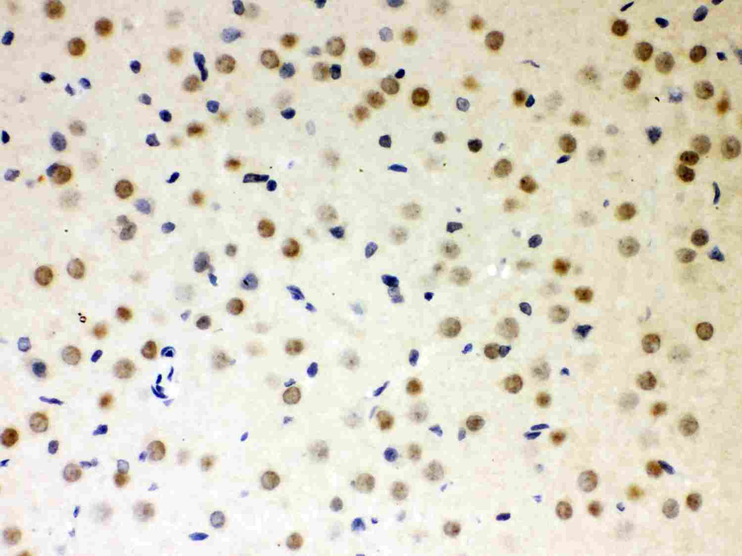 2 - Anti-PKC Iota Picoband Antibody ABO12012