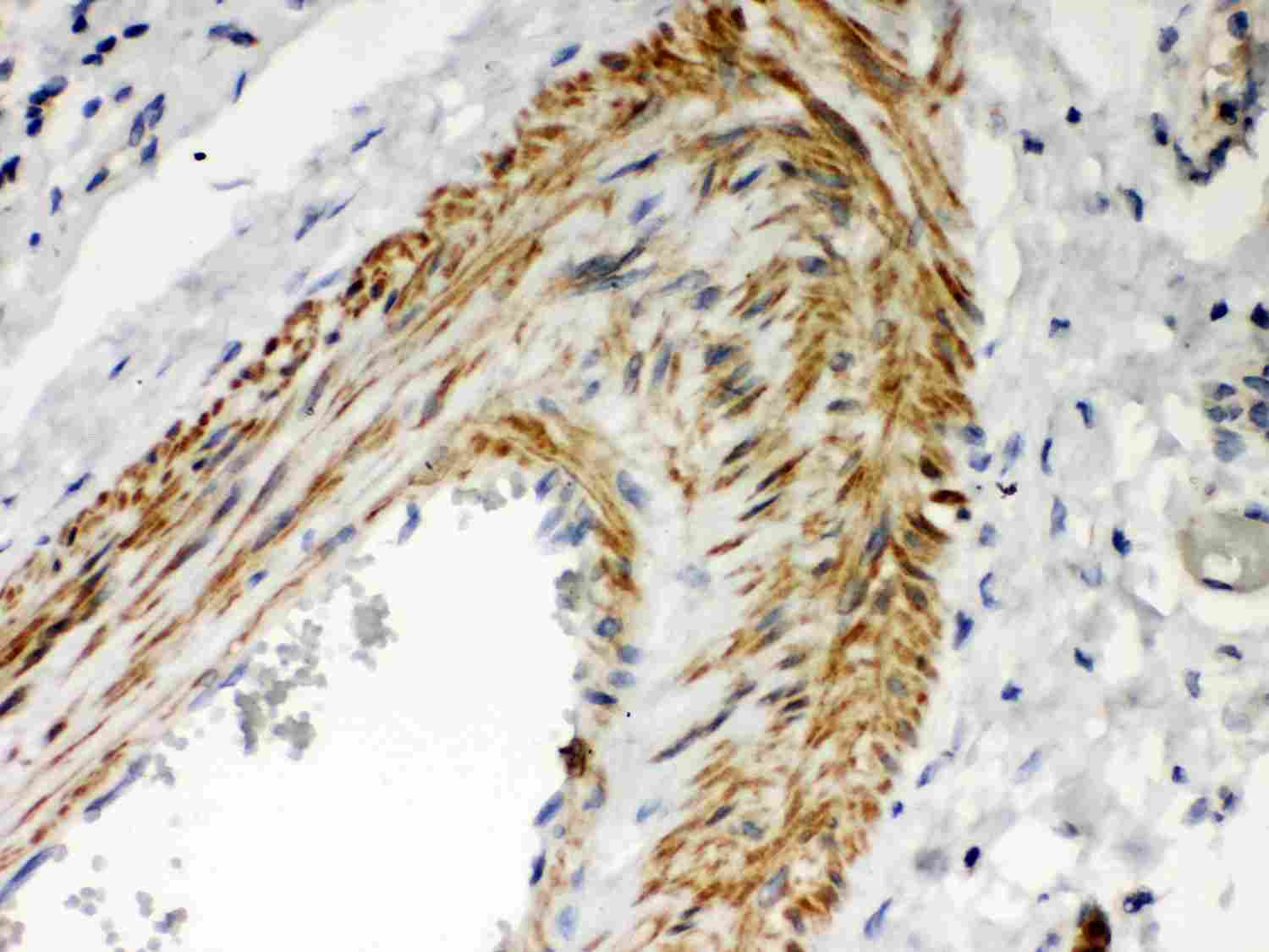 2 - Anti-PKC Iota Picoband Antibody ABO12012