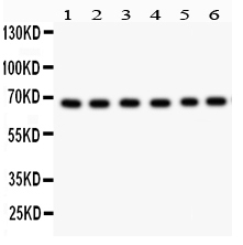 1 - Anti-PKC Iota Picoband Antibody ABO12012