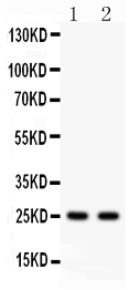 1 - Anti-Rab3A Picoband Antibody ABO12013