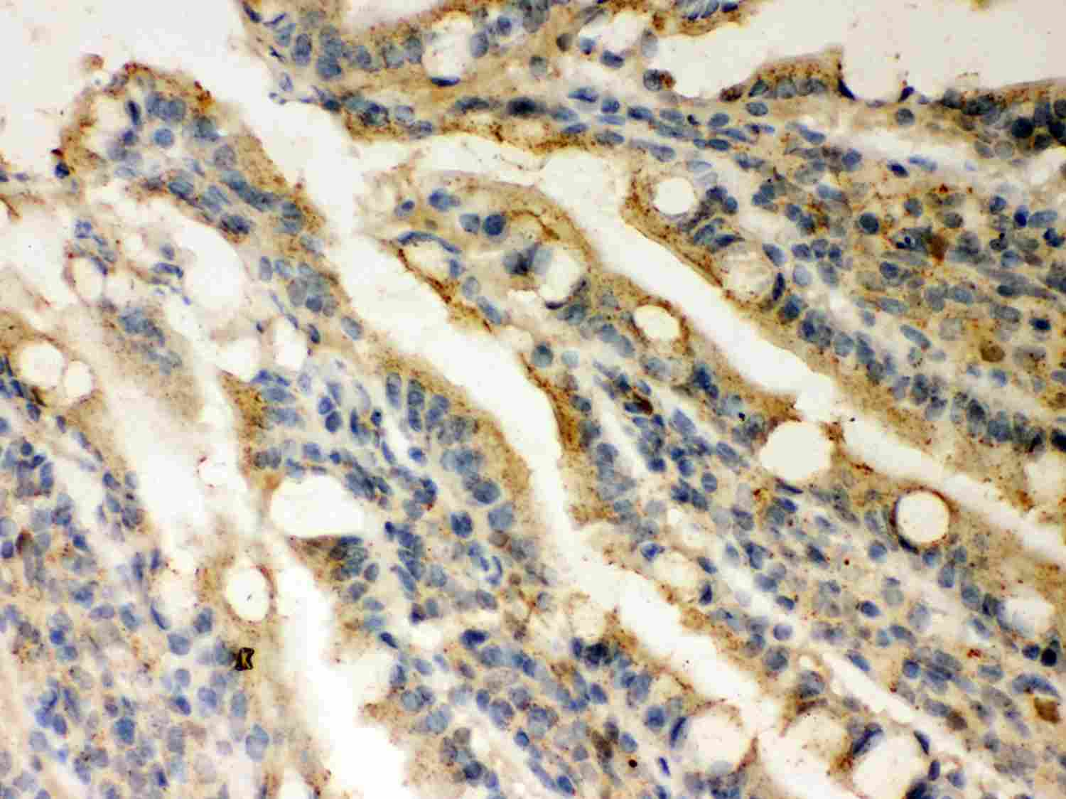2 - Anti-Rad51 Picoband Antibody ABO12014