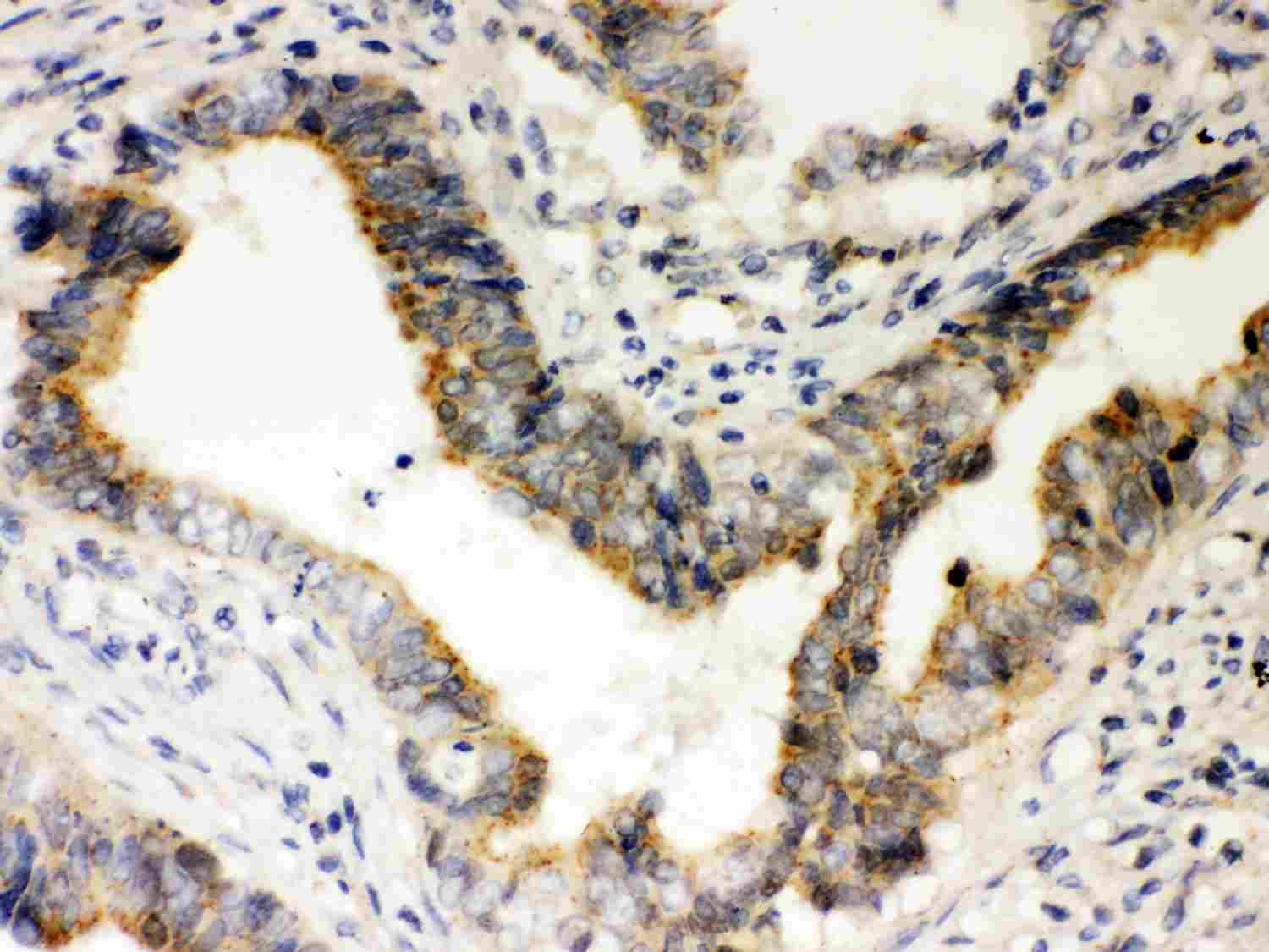 2 - Anti-Rad51 Picoband Antibody ABO12014