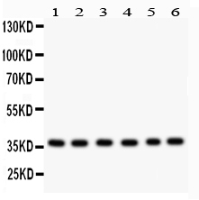 1 - Anti-Rad51 Picoband Antibody ABO12014
