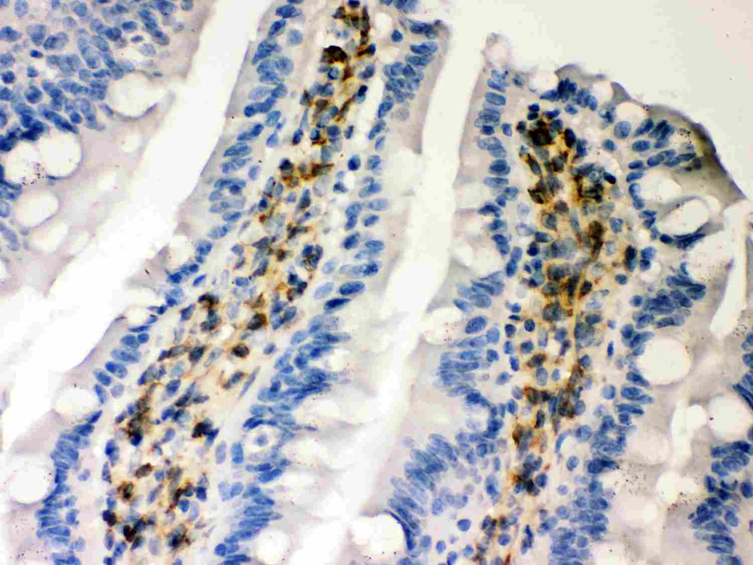 2 - Anti-Hsp47 Picoband Antibody ABO12016
