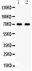 1 - Anti-SHBG Picoband Antibody ABO12017