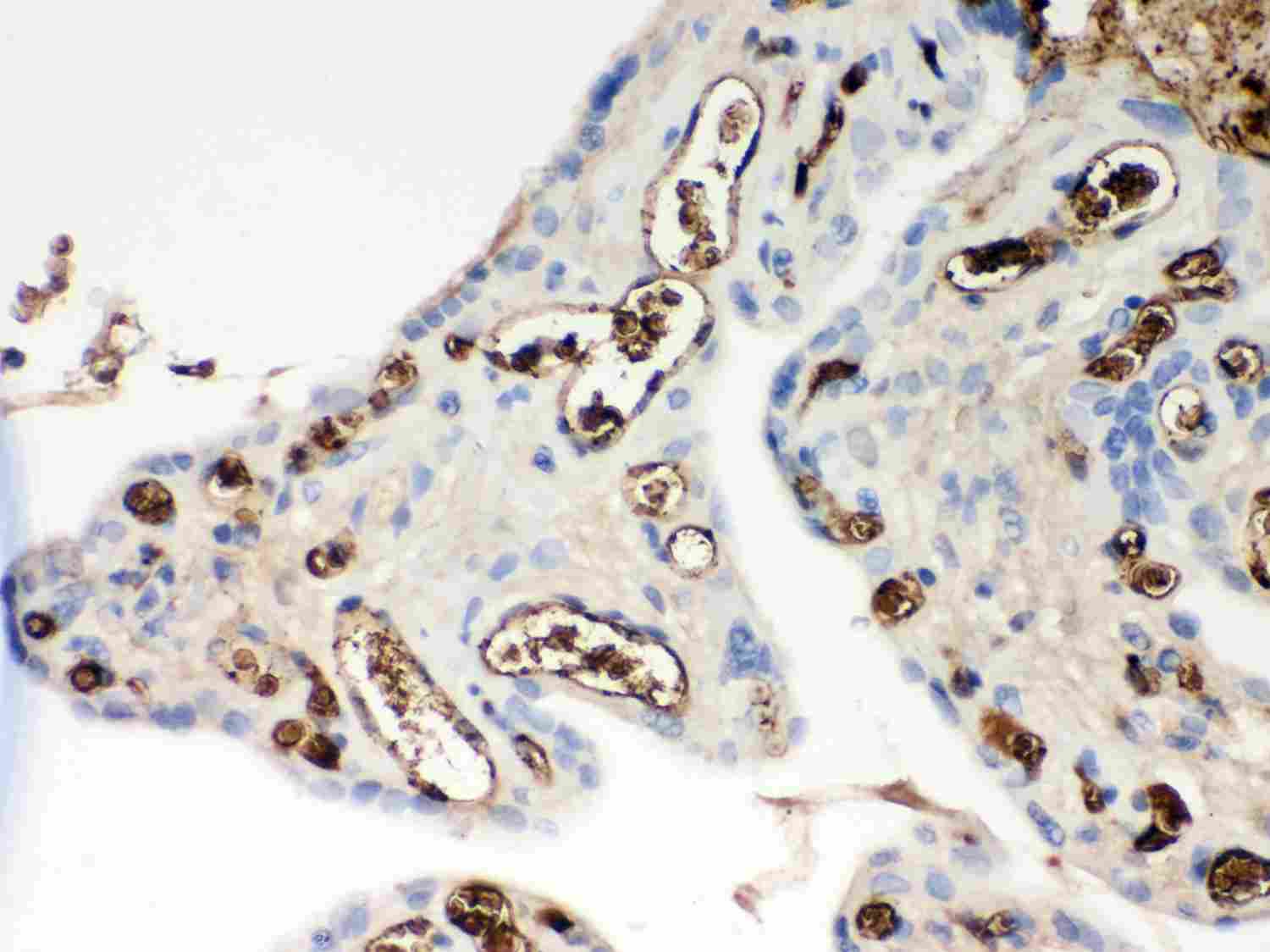 2 - Anti-APOE Antibody ABO12018
