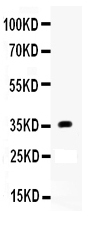 1 - Anti-APOE Antibody ABO12018