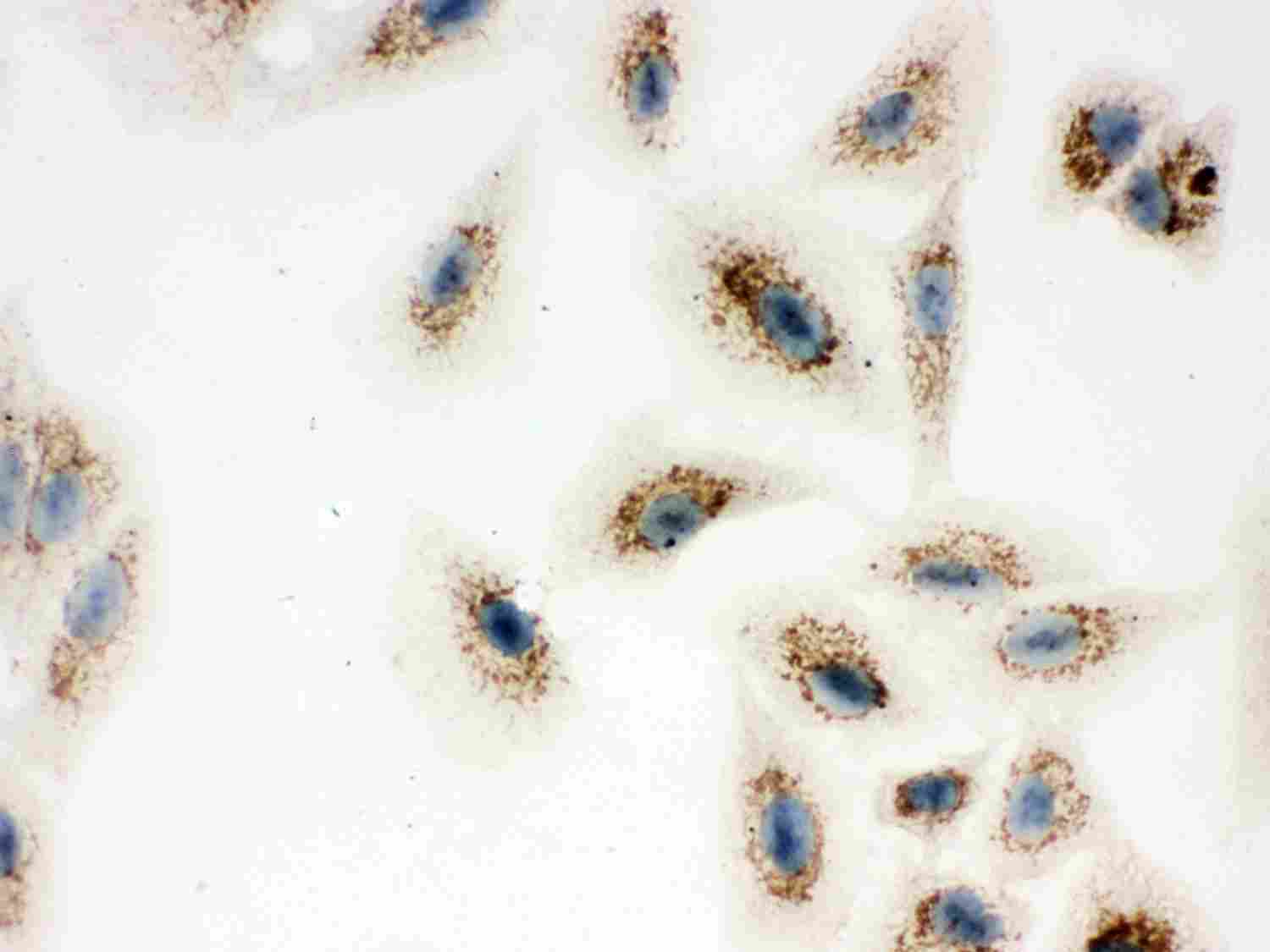 8 - Anti-ATP5H Picoband Antibody ABO12019