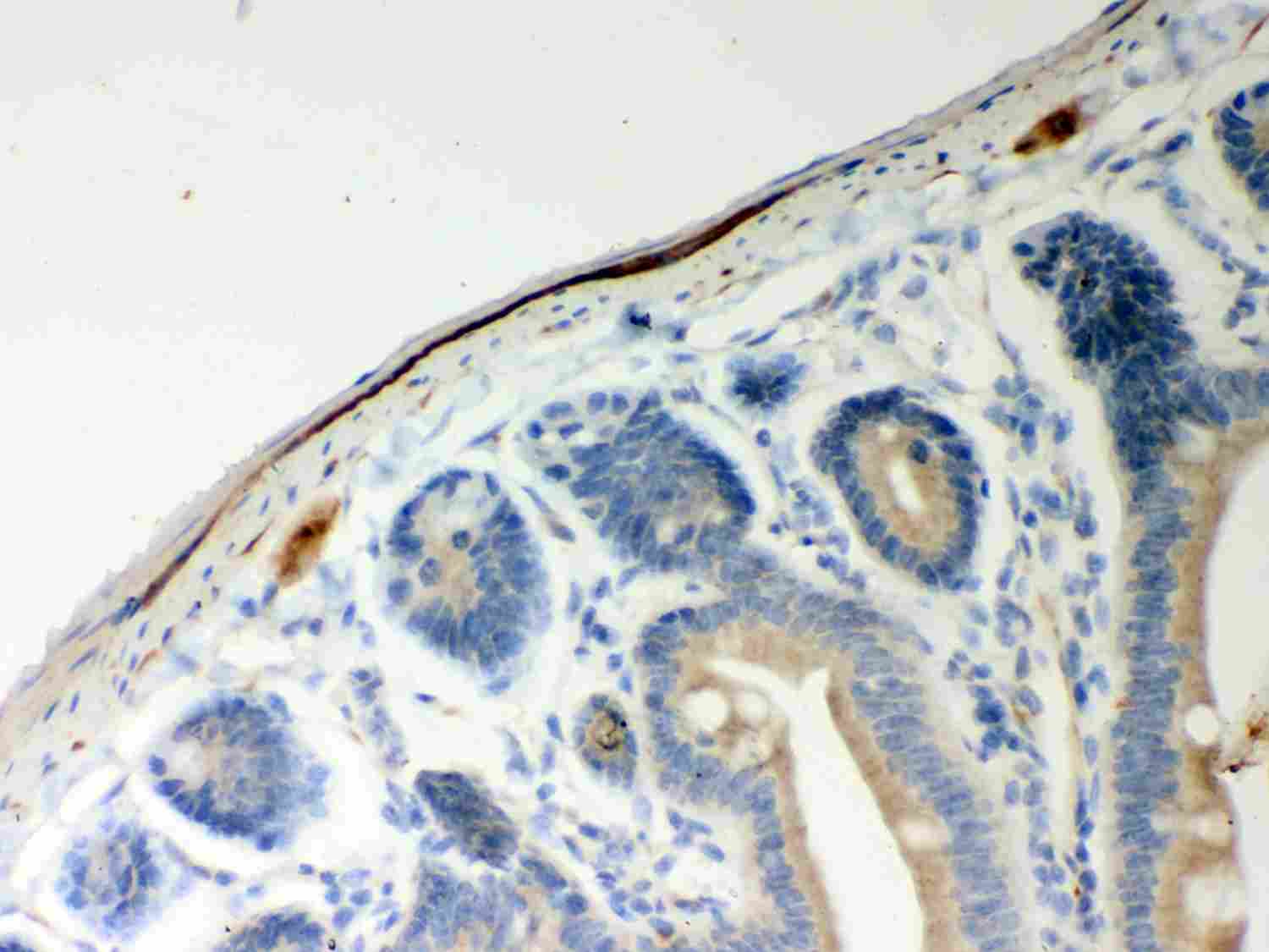 2 - Anti-ATP5H Picoband Antibody ABO12019